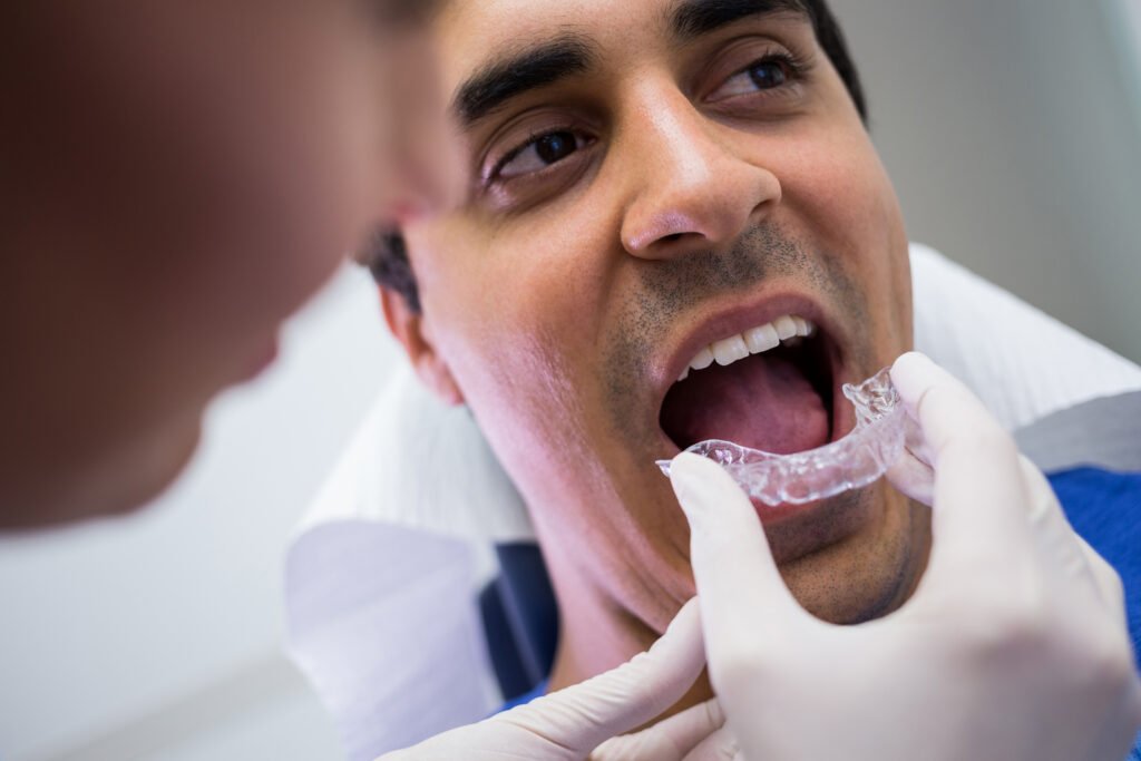 Dentista colocando os alinhadores transparentes em um paciente homem.